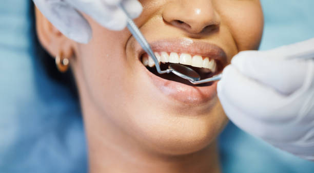 Best Dental Abscess Treatment in Toulon, IL